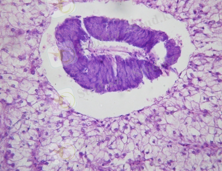 C:\Users\Admin\Desktop\Б - 10 т.к печень\гем-эозин_008.JPG