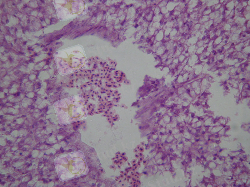 C:\Users\Admin\Desktop\Б - 12 А печень\гем-эозин_003.JPG