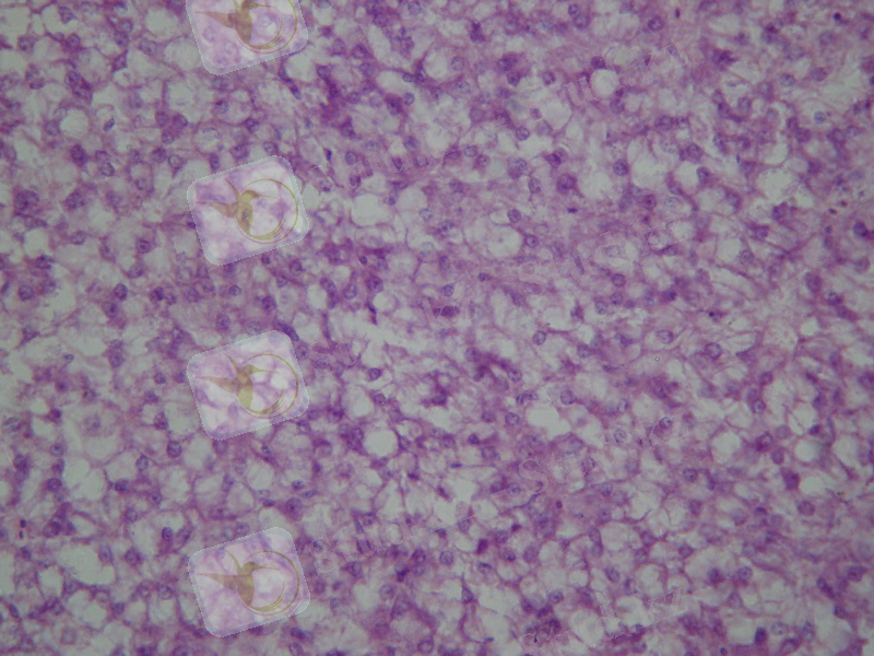 гем-эозин_004