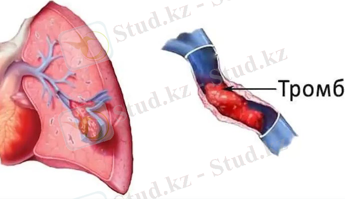 C:\Users\Жусипбек Калдыбай\Desktop\i.jpg