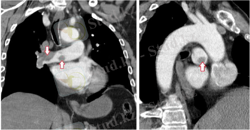 C:\Users\Жусипбек Калдыбай\Desktop\123.png