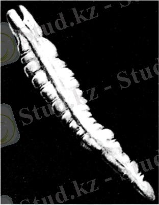 Лентец широкий Dipliillobotrium latum