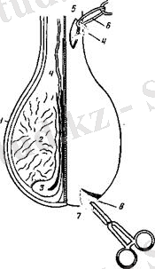Рис. 141. Оперативные доступы при вазэктомии быков и баранов (пунктиром показаны места перерезки спермиопровода и хвоста придатка):