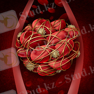 Blood clot