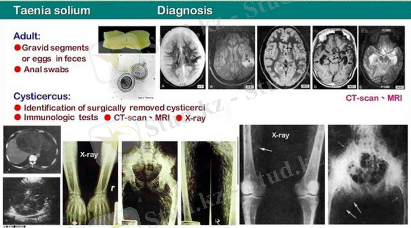 D:\Диск D\ТАТА\РАБОТА\МЕДИНСТИТУТ\СТУДЕНТЫ МОИ\МОИ ПАРАЗИТЫ\ЛЕКЦИИ\2 semester\Лекции для АФРИКИ 2009-10\Lecture 2.5\slaid 15.jpg