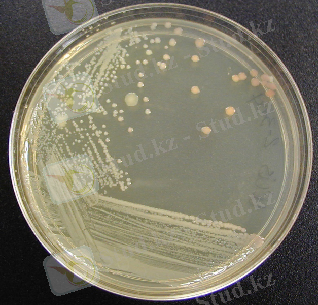 http://faculty.collin.edu/mweis/Microbiology/Lab/Lab%20Exercises/colony_characteristics/photos_drw/micro_cultural_char_agar.jpg