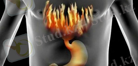 Картинки по запросу "қыжыл""