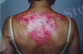 Картинка 12 из 108