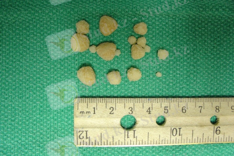 Описание: Камни