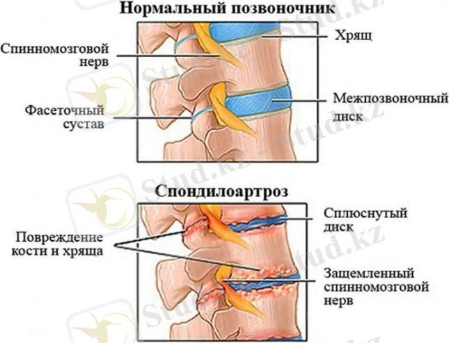 Картинки по запросу "спондилез и спондилоартроз у животных"