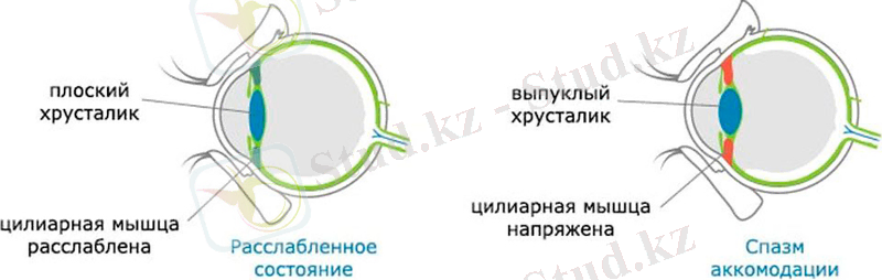 Спазм аккомодации глаз: что это, как снять, лечение, симптомы, капли «Ochkov.net»