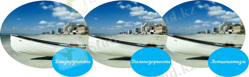 Близорукость. Дальнозоркость. Астигматизм. | Клиника Добрый Доктор