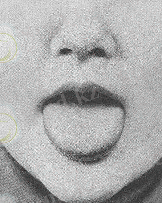 артикуляционная гимнастика