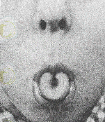 артикуляционная гимнастика