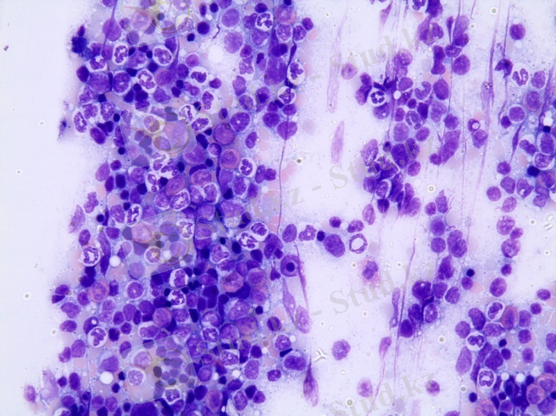 C:\Users\USER\Desktop\Кроветворная и иммуннаясистема\Қан түзу-14, МФ-20ДОТ\МФ 14\Гемопоэз-қызыл кемікте г.э. 400.jpg