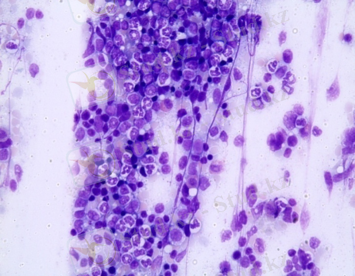 C:\Users\USER\Desktop\Кроветворная и иммуннаясистема\Қан түзу-14, МФ-20ДОТ\МФ 14\Ретикулярлы жасушалар-қызыл кемікте, г.э. 400.jpg