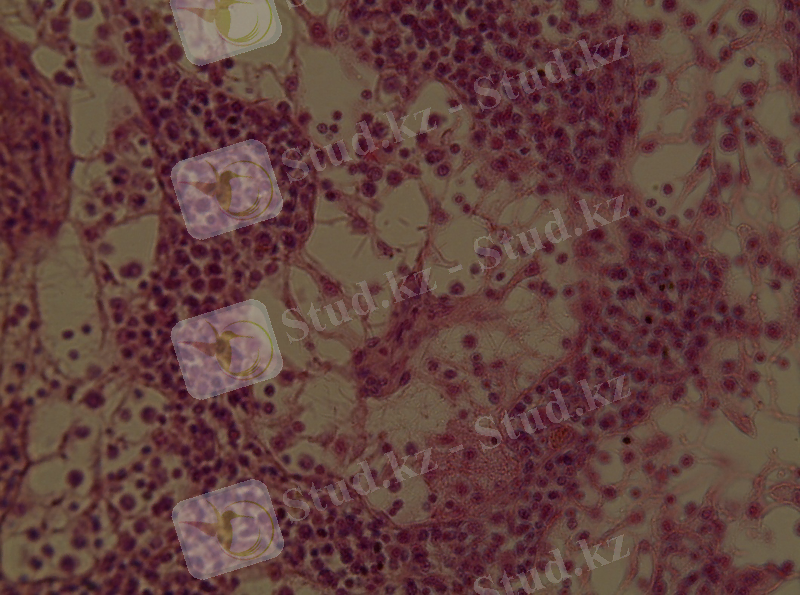 G:\Қан түзу-14\МФ 14\Ретикулярлы строма-лимфа түйінінде, г.э. 400.jpg