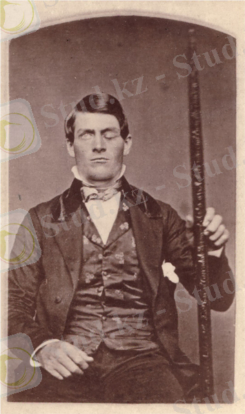 Бұл суретте Финеас Гейдж оның префронтальды қыртысын қадағалап тұрған металл шыбықты ұстап тұрғанын көрсетеді.