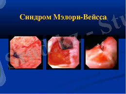 D:\Нурхан 4-курс\Без названия.jpg