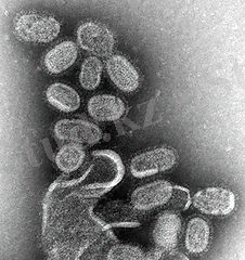 http://upload.wikimedia.org/wikipedia/commons/thumb/a/a4/EM_of_influenza_virus.jpg/226px-EM_of_influenza_virus.jpg