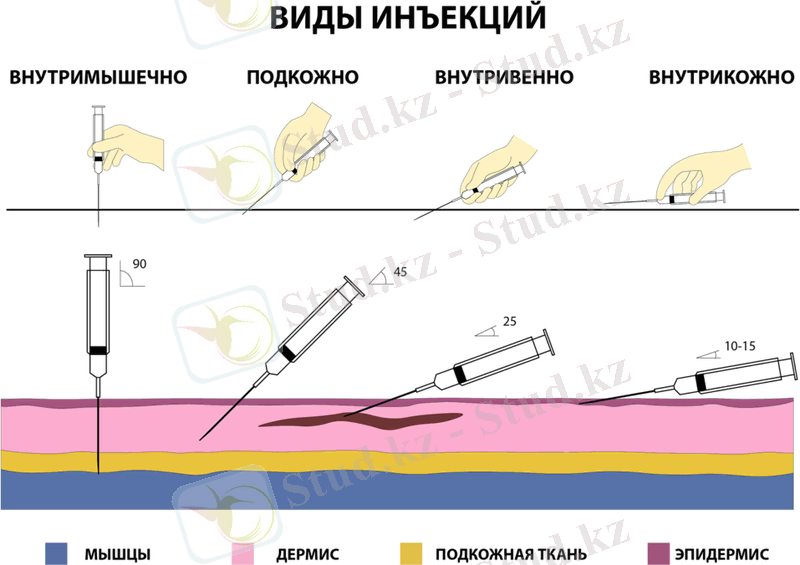 C:\Users\User\Desktop\Қаныш\1200px-Виды_медицинских_инъекций.png