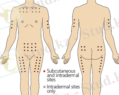 Безопасная техника инъекций | Санкт-Петербургский центр последипломного образования работников со средним медицинским и фармацевтическим образованием ФМБА России