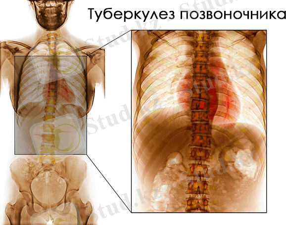 D:\Desktop\Новая папка\tp1.jpg