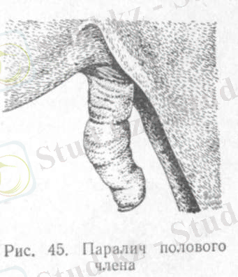 пениса параличі