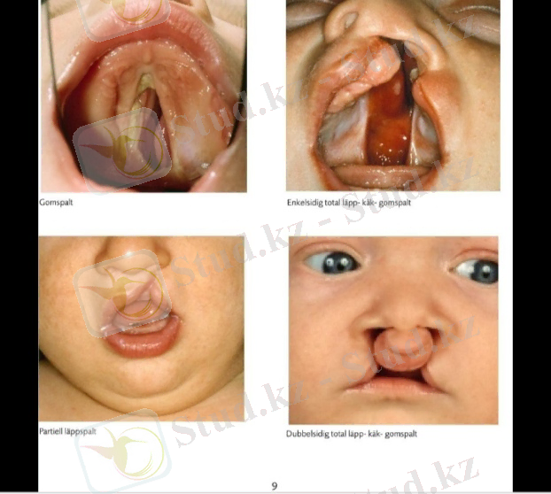 C:\Users\naske\Desktop\kjj\WhatsApp Image 2020-09-17 at 01.56.23.jpeg