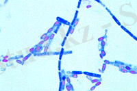 Картинки по запросу Clostridium septicum