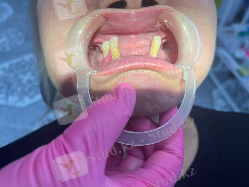 C:\Users\zhas_\Desktop\гылыми конф\d1f41e81-bc10-4238-817b-a88543bc1b0e.jpg