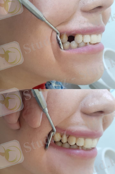 C:\Users\zhas_\Desktop\гылыми конф\dc889168-9974-4984-b34e-33a64d0f8cb8.jpg