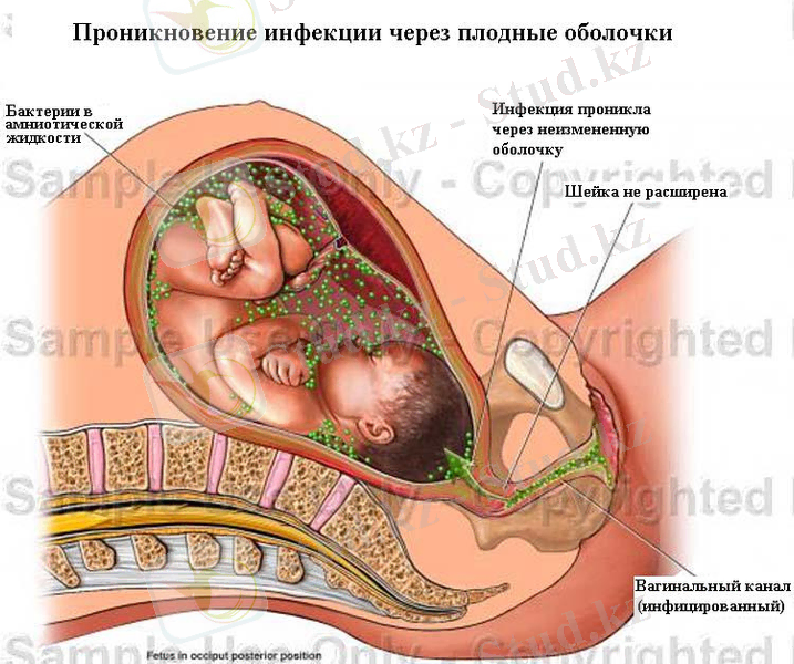 из влагал к плоду