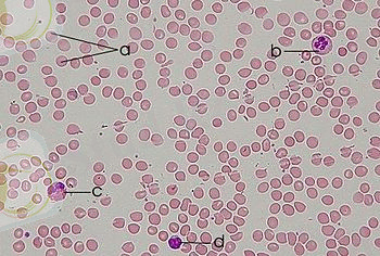 350px-Blood_smear.jpg