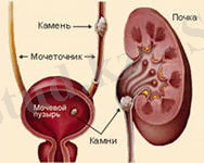 Описание: http://med-kz.ucoz.com/_pu/0/73078296.jpg
