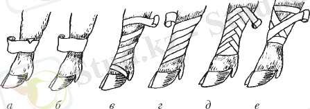 Наложение различных видов бинтовой иммобилизирующей повязки на конечность