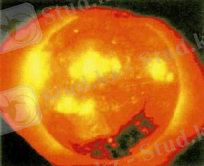 Научная%20Сеть%20%20Солнце%20в%20рентгеновских%20лучах.files/0001_096.1.preview.jpg