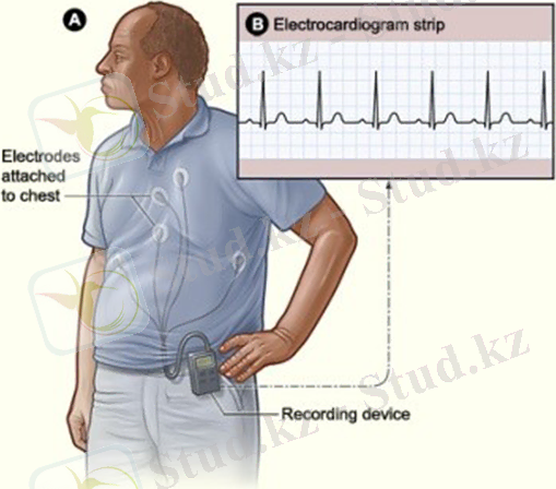 Существующие показания для выполнения холтер-мониторинга