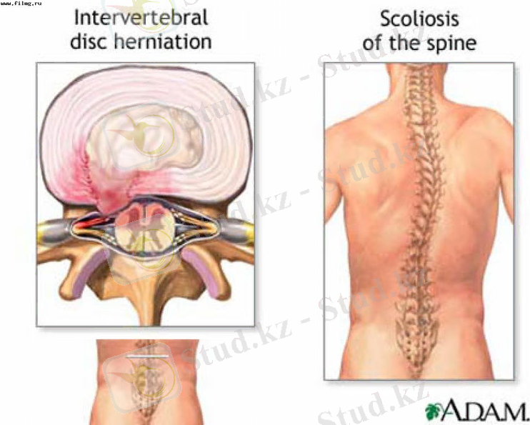 C:\Users\compaq\Desktop\гистология сөж\kostoprav-lechenie-pozvonochnika-i-sustavov.--3948-1330612802992438-3-big[1].jpg