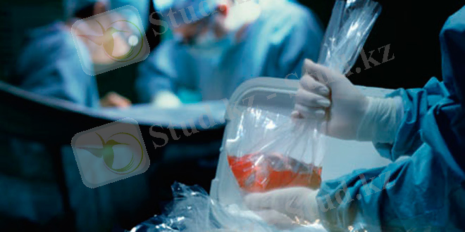 Human organ transplant 008 ТРАНСПЛАНТОЛОГИЯ ТҮЙТКІЛІ НЕДЕ?
