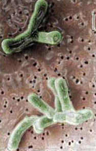 дисбактериоз