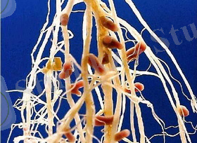 http://agrobelarus.ru/sites/default/files/rhizobium-nodule.jpg