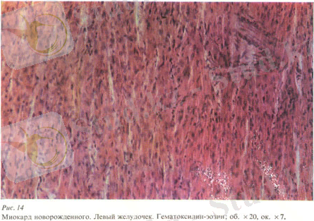 Рис.14. Миокард новорожденного. Левый желудочек.