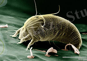 https://upload.wikimedia.org/wikipedia/commons/thumb/5/51/Rust_Mite,_Aceria_anthocoptes.jpg/280px-Rust_Mite,_Aceria_anthocoptes.jpg