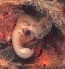 Жетілмей қалған жүктілік кезіндегі ұрық