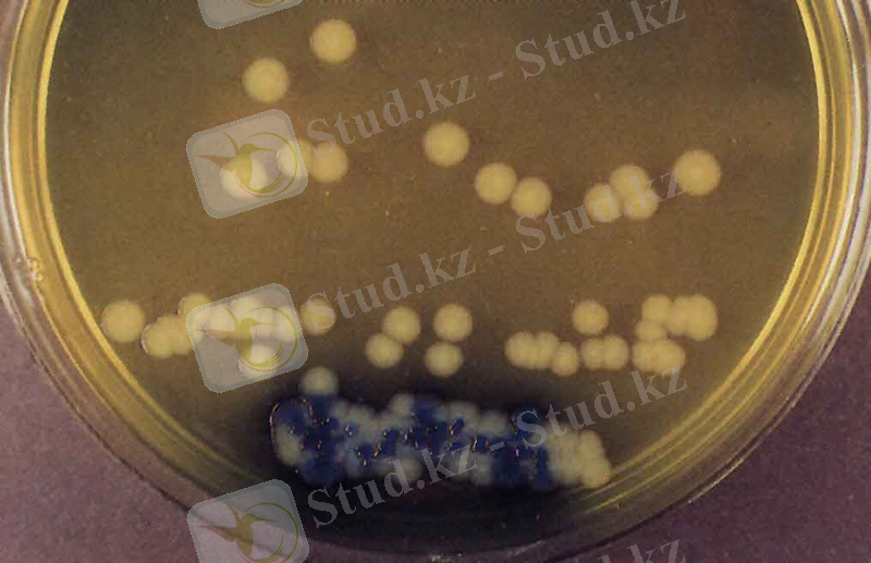 http://nsau.edu.ru/images/vetfac/images/ebooks/microbiology/stu/micro/pict/salmonell_l.jpg
