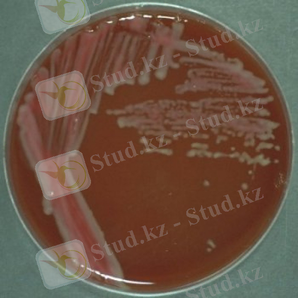 Campylobacter jejuni..jpg