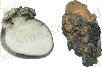 Картинки по запросу рак картофеля