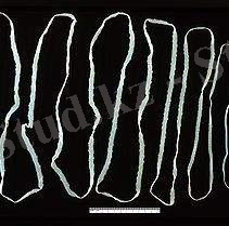 Бычий цепень