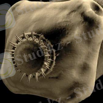 Сколекс свиного солитера, или, как его еще называют, вооруженного цепня (Taenia solium)